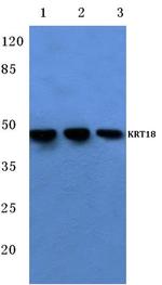 Cytokeratin 18 Antibody in Western Blot (WB)
