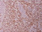 Cytokeratin 18 Antibody in Immunohistochemistry (Paraffin) (IHC (P))