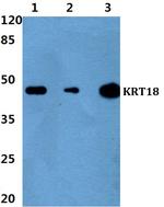 Cytokeratin 18 Antibody in Western Blot (WB)