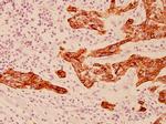 Cytokeratin 19 Antibody in Immunohistochemistry (Paraffin) (IHC (P))