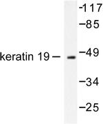 Cytokeratin 19 Antibody in Western Blot (WB)