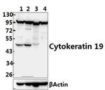 Cytokeratin 19 Antibody in Western Blot (WB)