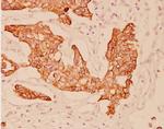 Cytokeratin 20 Polyclonal Antibody