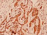 Cytokeratin 5 Antibody in Immunohistochemistry (Paraffin) (IHC (P))