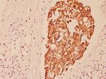 Cytokeratin 7 Polyclonal Antibody
