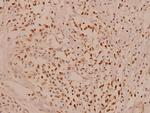 MCL-1 Polyclonal Antibody