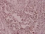 MCM2 Polyclonal Antibody