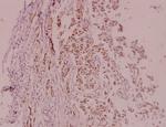MDM2 Polyclonal Antibody