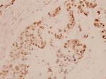 MEF2A Polyclonal Antibody