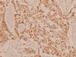 MEK3 Polyclonal Antibody