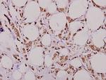 MMP7 Antibody in Immunohistochemistry (Paraffin) (IHC (P))