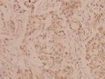 MMP8 Polyclonal Antibody
