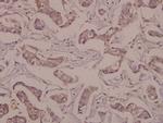 NSE Polyclonal Antibody