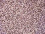 p14ARF Polyclonal Antibody