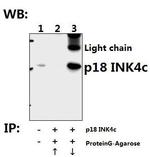 CDKN2C Antibody in Immunoprecipitation (IP)
