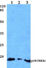 CDKN2C Antibody in Western Blot (WB)