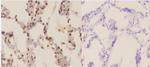 NBS1 Antibody in Immunohistochemistry (Paraffin) (IHC (P))