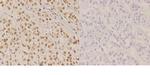 NBS1 Polyclonal Antibody