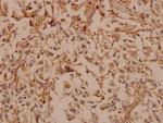 PDGF-B Polyclonal Antibody