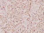 c-Rel Polyclonal Antibody