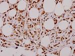 STAT3 Polyclonal Antibody