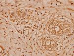 Cystatin B Polyclonal Antibody