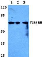 TGFBR2 Polyclonal Antibody