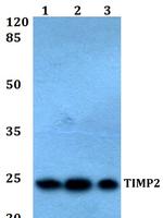 TIMP2 Polyclonal Antibody