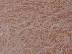 VAV1 Antibody in Immunohistochemistry (Paraffin) (IHC (P))