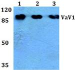 VAV1 Antibody in Western Blot (WB)