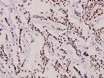 RUNX1 Polyclonal Antibody