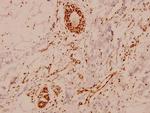 MEF2A Polyclonal Antibody