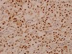 E2F1 Polyclonal Antibody