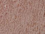 GSK3B Polyclonal Antibody
