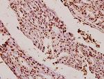 Ku80 Polyclonal Antibody