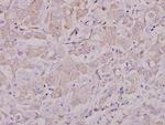Lyn Polyclonal Antibody