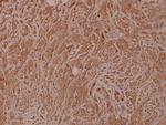 BAD Polyclonal Antibody
