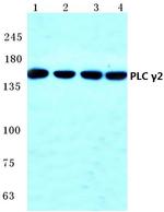 PLCG2 Antibody in Western Blot (WB)