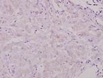 SHC Polyclonal Antibody