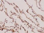 gamma Synuclein Polyclonal Antibody