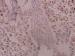 TrkA Polyclonal Antibody