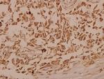 TrkB Polyclonal Antibody