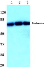 Caldesmon Antibody in Western Blot (WB)