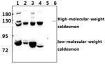 Caldesmon Antibody in Western Blot (WB)