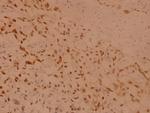 RSK1 Antibody in Immunohistochemistry (Paraffin) (IHC (P))