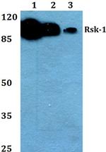 RSK1 Antibody in Western Blot (WB)