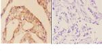 Cardiac Troponin I Polyclonal Antibody