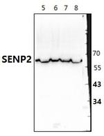 SENP2 Polyclonal Antibody