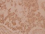 gamma Tubulin Polyclonal Antibody