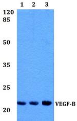 VEGFB Polyclonal Antibody